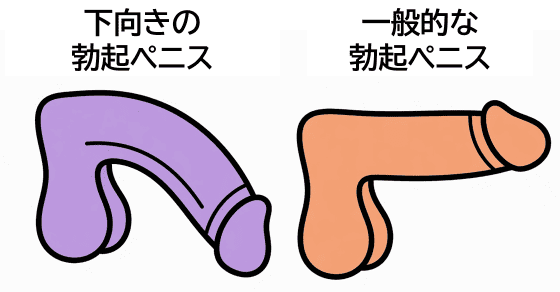 下向きチンコ