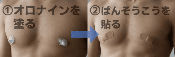 オロナイン 乳首